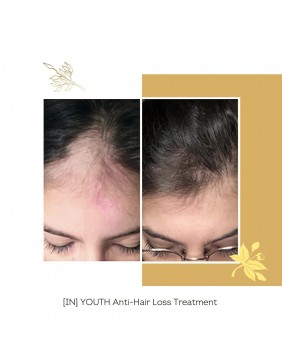 FLOREVE (IN) YOUTH ANTI HAIR LOSS – natūralus maisto papildas plaukų stiprinimui ir jų slinkimo mažinimui