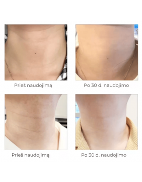 Arocell Super Neck Cream intensyvaus poveikio kaklo kremas 80g