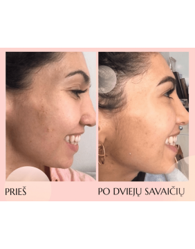 FLOREVE (IN) DETOX – natūralus maisto papildas odos būklei ir apsauginiam barjerui palaikyti