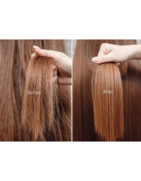 Apothe Sebum Control Shampoo – profesionalus šampūnas riebiai galvos odai