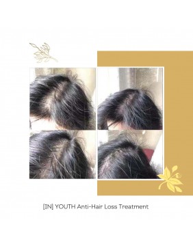 FLOREVE natūralus maisto papildas su keratinu nuo plaukų slinkimo ir plaukų augimui skatinti (IN) YOUTH ANTI HAIR LOSS